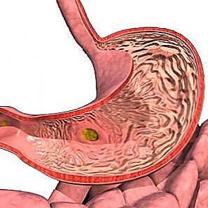 Gastroduodenitis - léčba lidových léků / Krása a zdraví