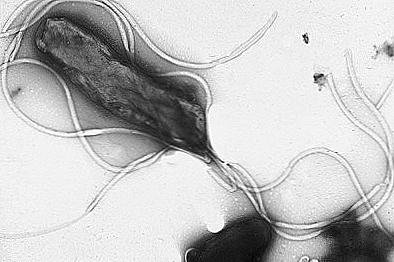 Symptomy a léčbu Helicobacter pylori / Krása a zdraví