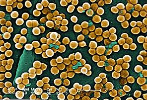 Как се предава Staphylococcus aureus / Красота и здраве