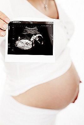 Ultrazvuk tijekom trudnoće / trudnoća